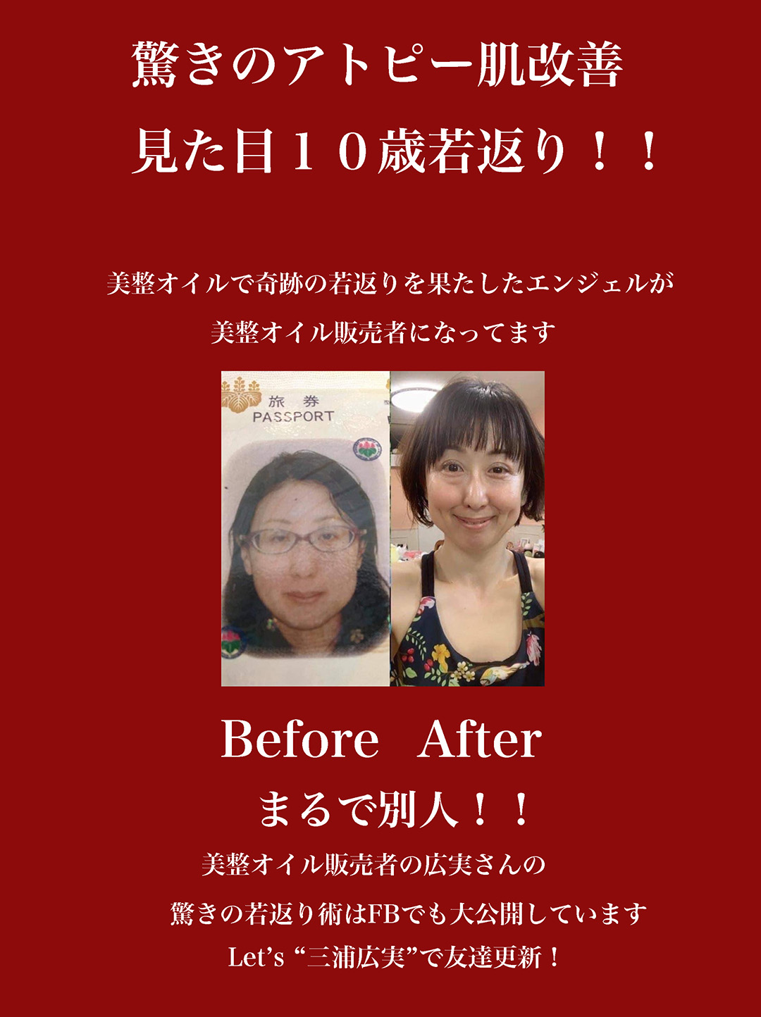 広実さん